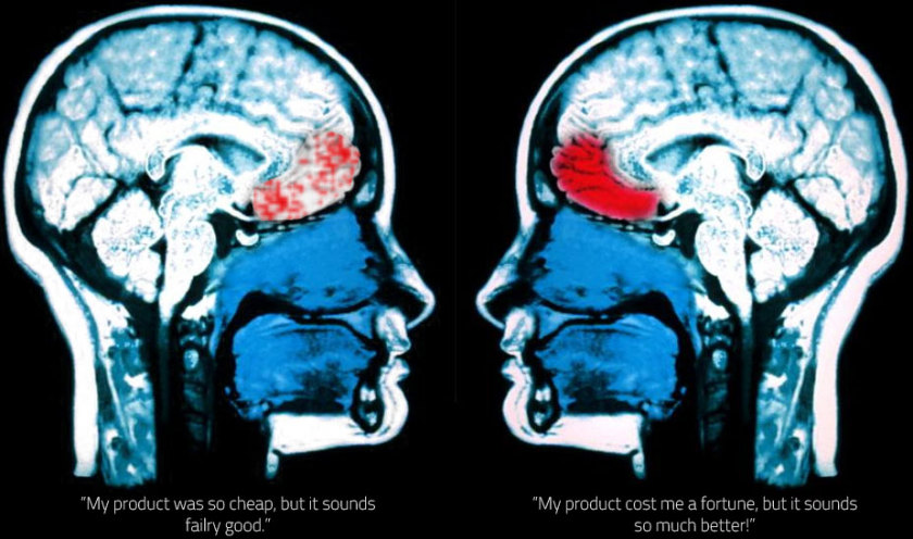 Frontal Cortex Activity during MRI scan